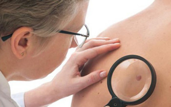 VDO_hanseníase_cred reprodução